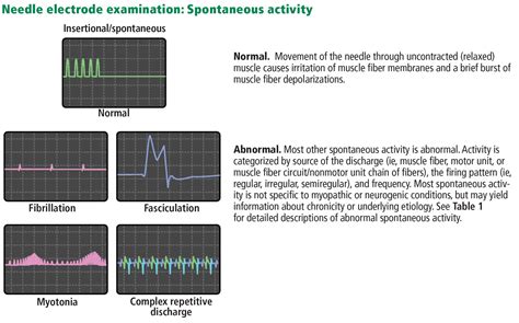 interpreting emg results|how to read emg report.